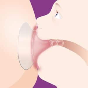 2 Paracapezzoli Small - AVENT - immagine 2